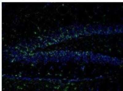 Immunohistochemistry: NMDAR2B [p Tyr1336] Antibody [NB300-295]